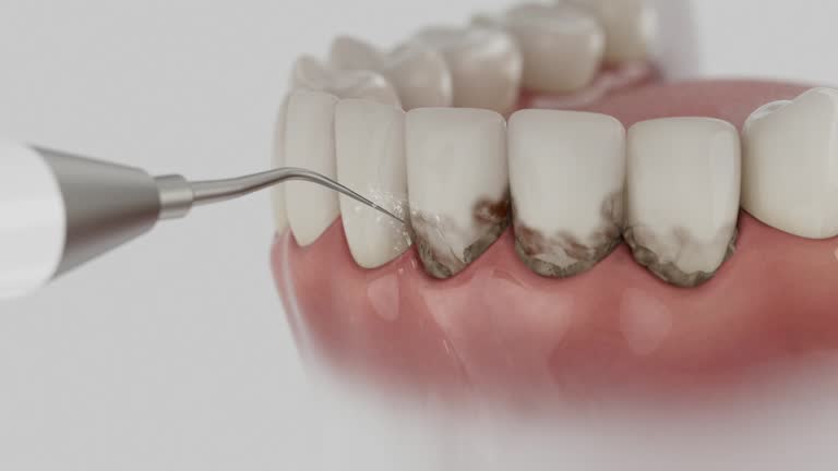 Reliable Dental Implants contractor in Des Plaines, IL by Smile Center Dentistry